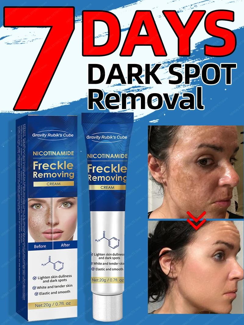 Dark Spot Remover For Face Cream Black Age 1