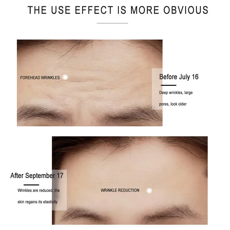 Yoxier Forehead Wrinkle Removal Patch Fade Forehead Lines Forehead Firming Mask Frown Lines Treatment Stickers Lifting Skin Care