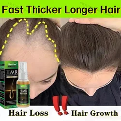 Ginger Hair Growth Oil Fast Thicker Longer Biotin Promote Hair Regrowth Serum Spray Baldnes Damage Scalp Treat Anti Loss Product