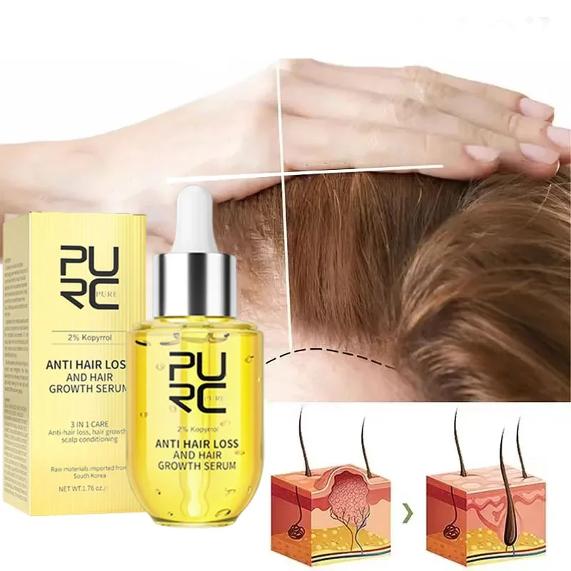 

PURC Fast Hair Growth for Men Women Ginger Oil Care Anti Hair Loss Scalp Treatment Serum Beauty Health Products