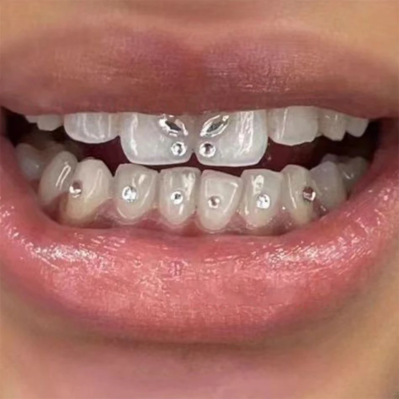 Kit 4 Coppie Cristalli Per Denti - Decorazioni Dentali Con Strass E Pietre Preziose - Foto 4