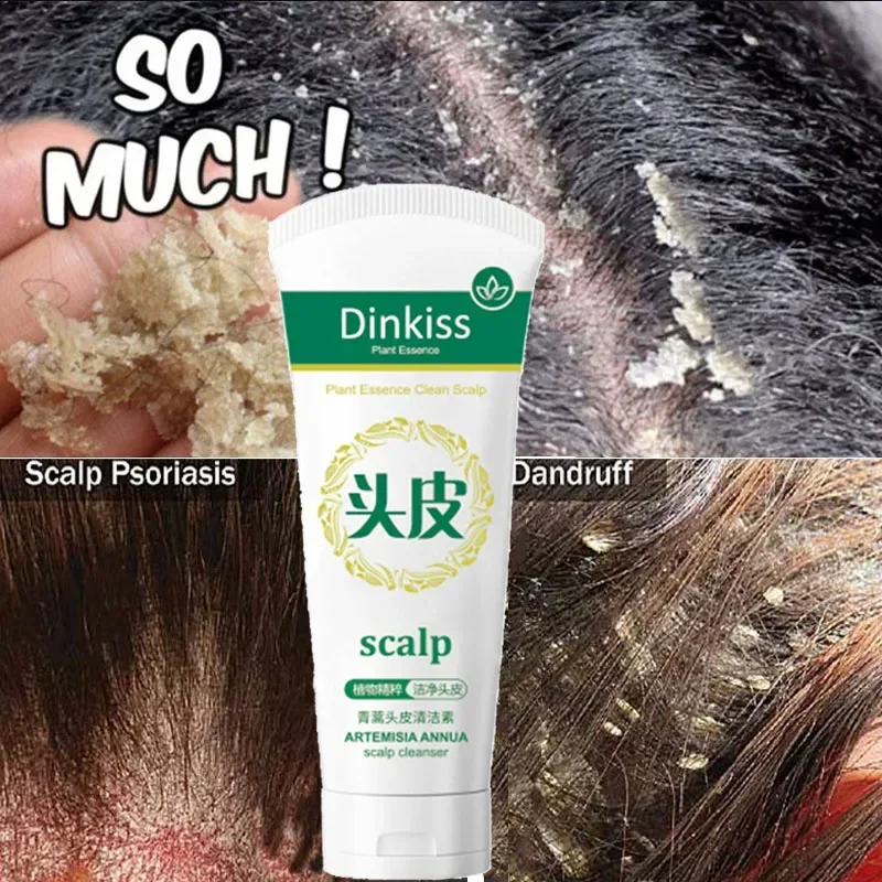 

Herbal Scalp Cleansing Shampoo Remove Dandruff Anti Itching Antibacterial Treat Seborrheic Oil Control Repair Scalp Care 120ml