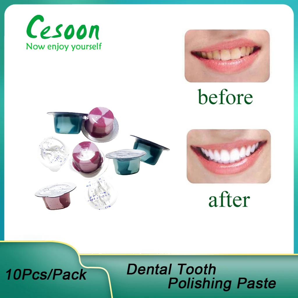 Cesoon10PcsDentalToothPolishingPasteTeethWhiteningPolisher