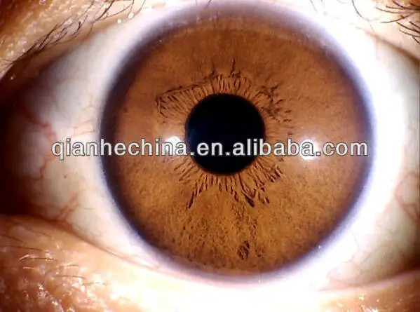 디지털 iridology 카메라 눈 이리스코프 iris 스캐너 5mp iris analyzer