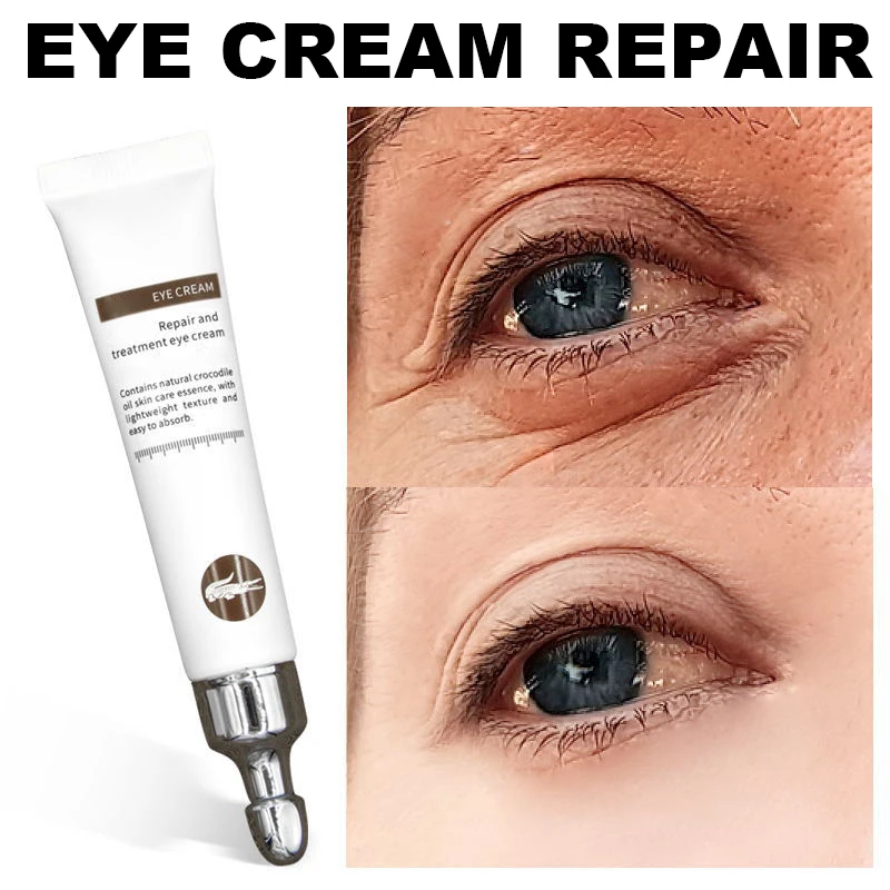 20g Magic Anti-Age Eye Cream Eye Serum Reduce Dark Circles Puffiness Under Bags Wrinkles Care Skin Care Products