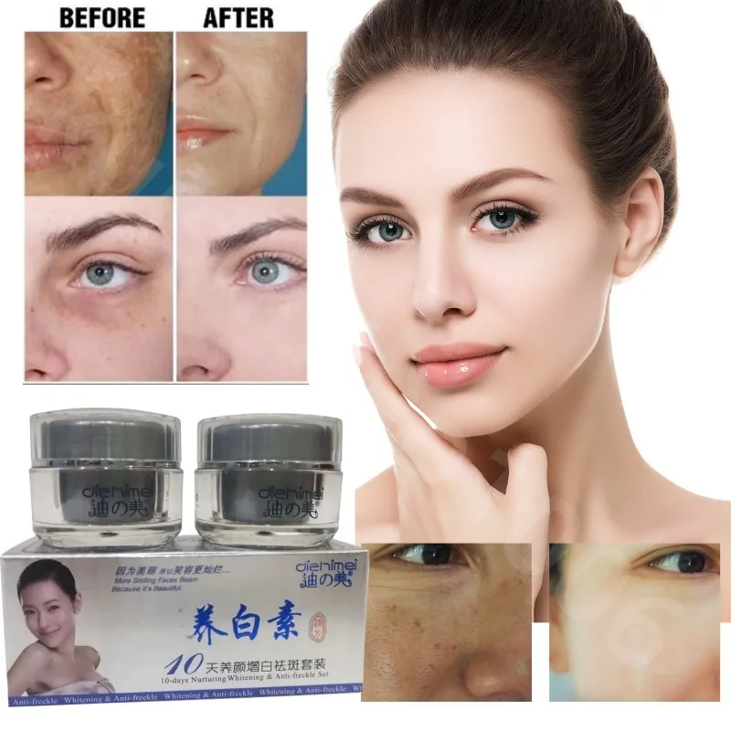 Anti-Pigment Face Whitening Cream Powerful Effects Whitening Anti Freckle Melasma Bleaching Remove Dark Spots Skin Care Products bleaching cream for dark skin intense top quality bleaching whitening cream for face neck hands and feet without side effects