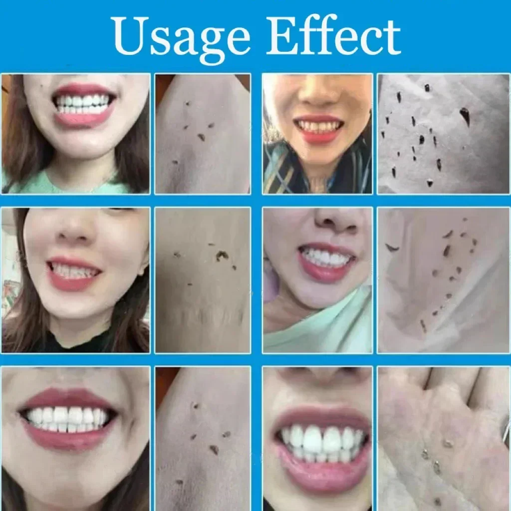 Dental Calculus Remover Teeth Whitening Spray Toothpaste Cleaning Oral Hygiene Removal Halitosis Plaque Stains Fresh Breath Care dental calculus remover