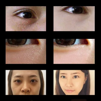 Eye Cream Eye Contour Fat Granule Remover Anti Dark Circle Eye Bags Anti Aging Whitening Eye Serum Korean Skin Care Products30ML - Thumbnail 2