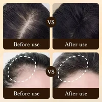 La croissance des cheveux, perte essentielle, traitement de repousse, renforce les cheveux, nourrit le cuir chevelu, léger, Non gras, améliore la Circulation du cuir chevelu 3