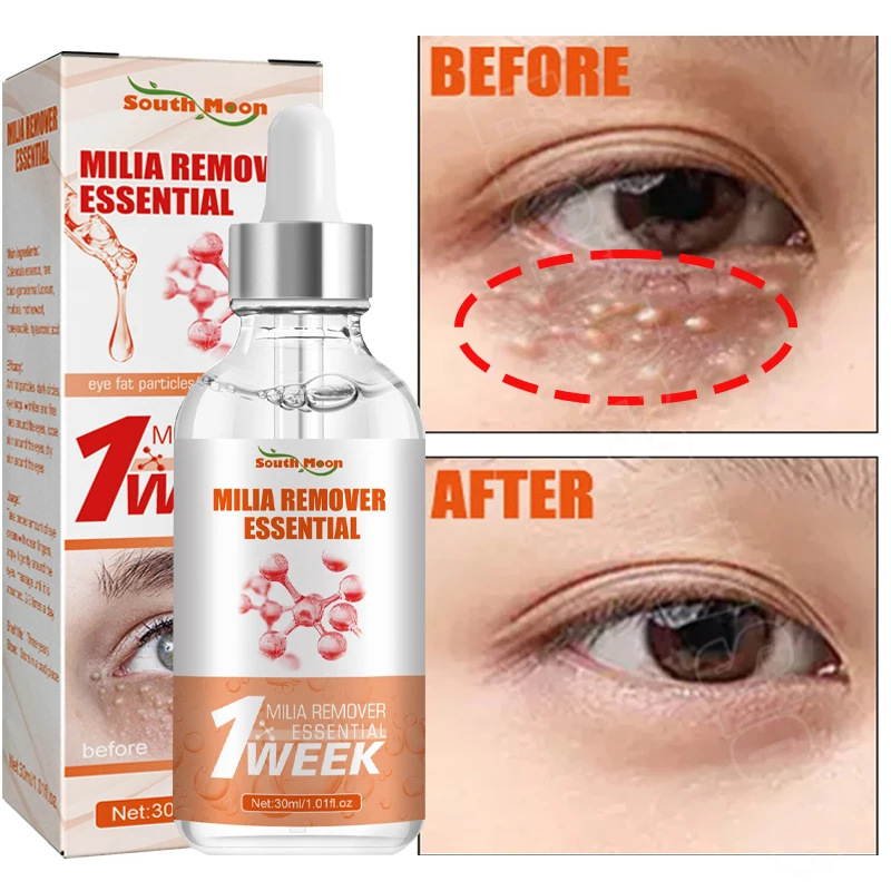 Fat Granules Removal Eye Serum Eye Milia Repair Treatment Products Wrinkle Lifting Moisturizing Anti-Puffiness Korean Skin Care fat granules removal eye serum fade dark circles eye bags essence moisturize fade fine line anti puffiness korean skin care