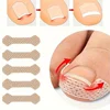 Ingrown Paronychia Toenail Corrector Strips Anti F 10pcs Ingrown Paronychia Toenail Corrector Strips Anti F 1