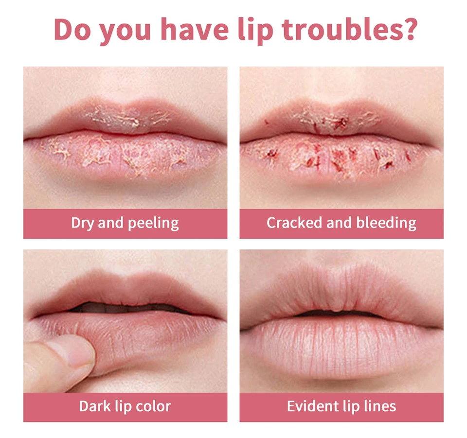 Labial hidratante de miel y vitamina e con efecto voluminizador_voghion.com