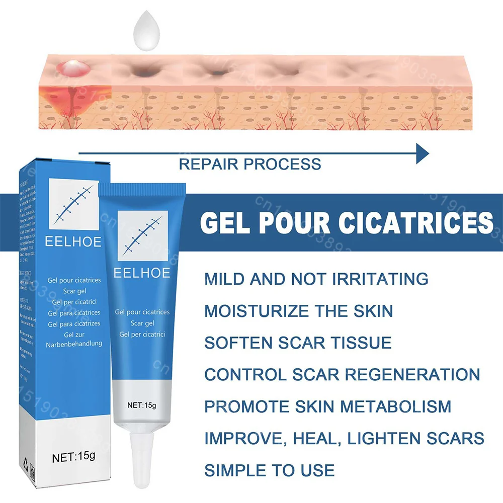 Recovery Scar Cream Fast Removal Skin Scars Treat Surgery Scars Stretch Marks Acne Pox Prints Burn Repair Facial Care Gel pain analgesic cream