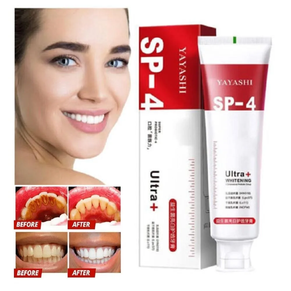 

120g Probiotic Whitening Toothpaste Teeth Whitening Toothpaste Oral Care Toothpaste Fresh Breath Prevents Plaque Mouth Care