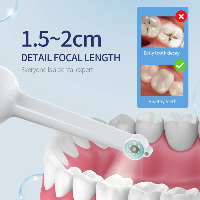 Wireless HD Intraoral Camera with LED Lighting