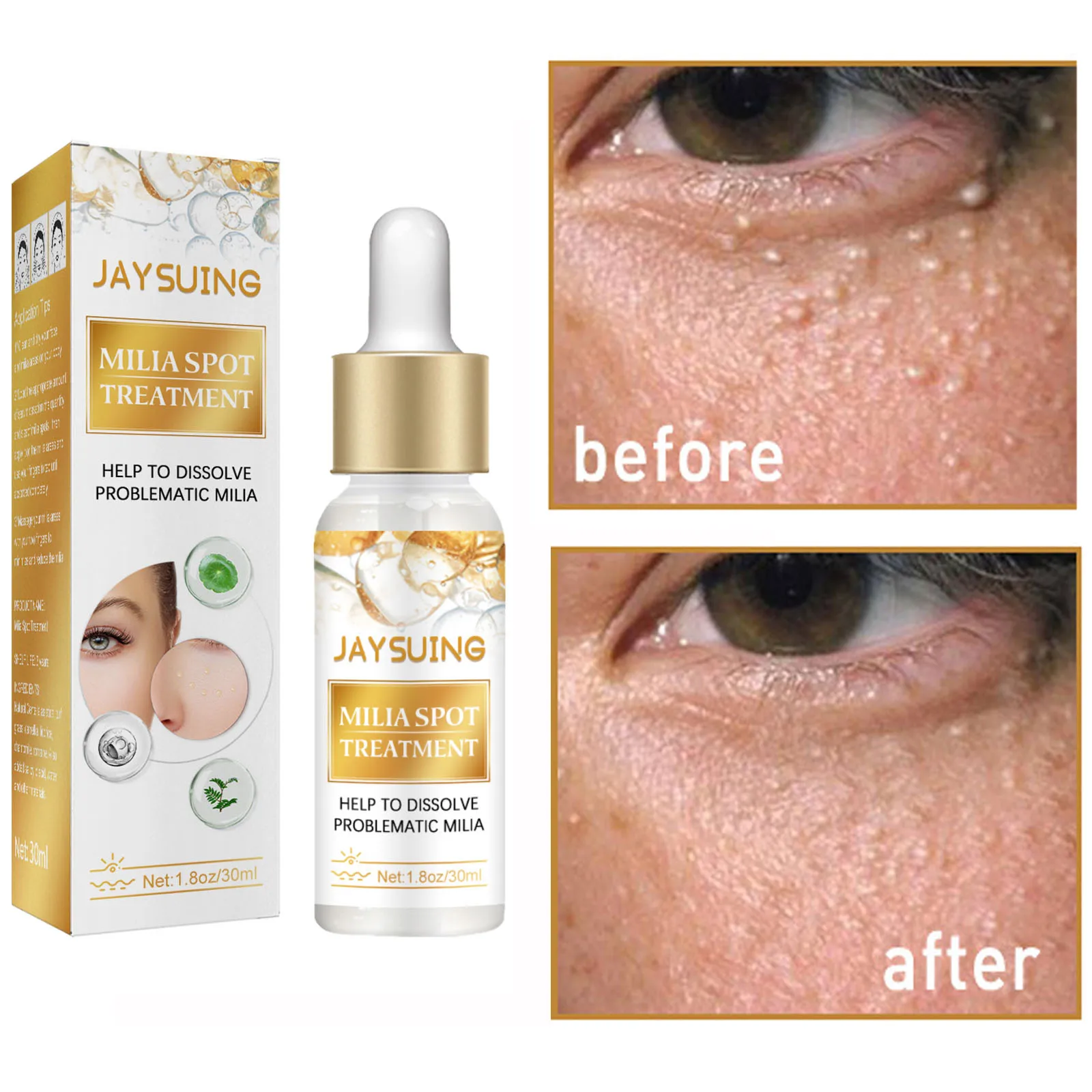 Milia Remover Serum Anti Dark Circles Fat Granules Removal Eye Bags Brighten Skin Care Anti-Puffiness Firming Beauty Cosmetics ansaligy лифтинг сыворотка для лица увлажняющая с сусальным золотом и янтарем moisturizing lifting serum with gold flakes and amber granules