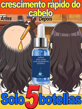 26Follicoli dormienti del risveglio per capelli abbondanti