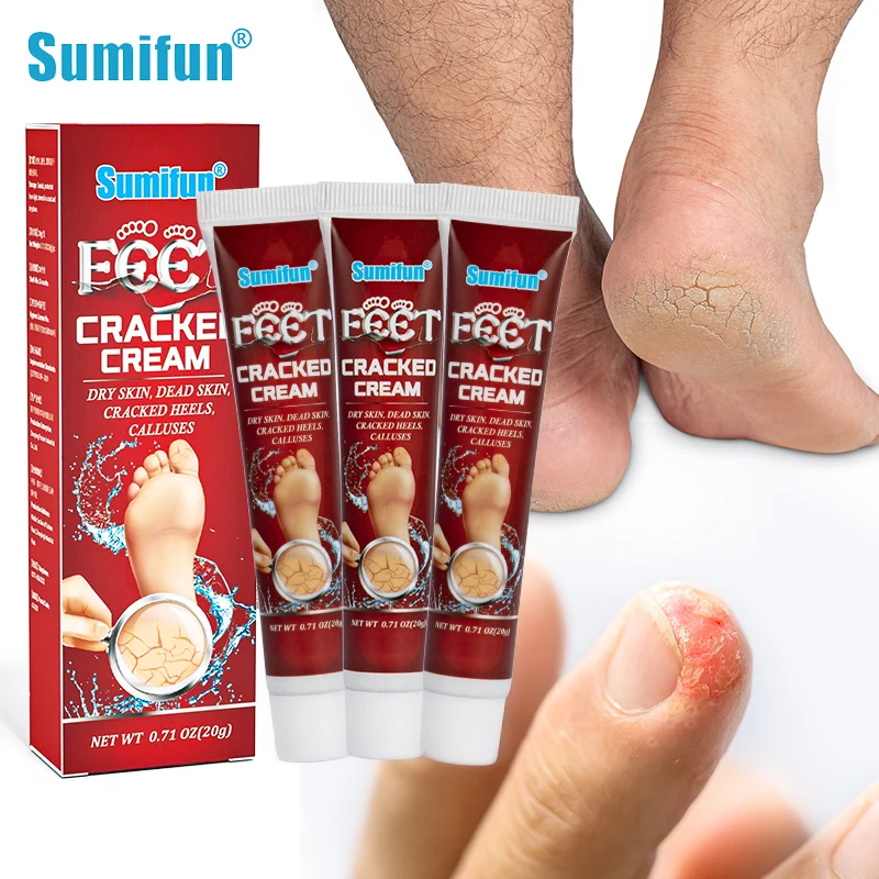 

3/5Pcs Sumifun Anti Crack Foot Cream Heel Repair Feet Peeling Dead Skin Remover Dry Skin Moisturizer Hand Callus Care Ointment