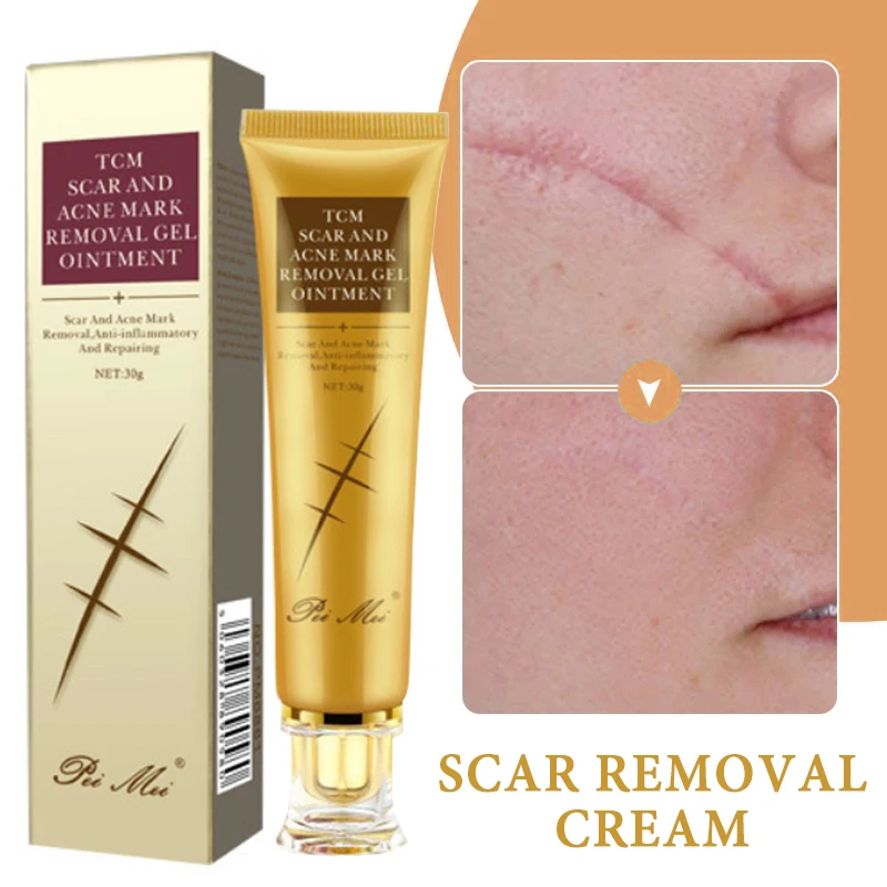 Scar Cream Gel Remove Acne Stretch Marks Pigmentation Moisturizing