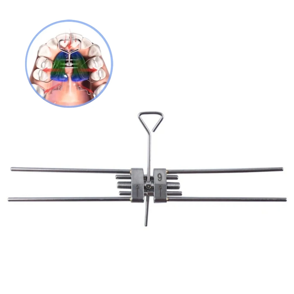 Trapano Odontotecnico 5 Size Dental Orthodontic Expansion Screws Rapid ...