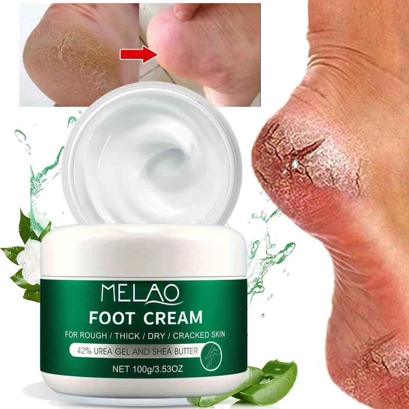 MELAO Urea Cream Salicylic Acid for Dry Cracked Feet Heels Knees Hands Repair Treatment Moisturizer Dead Skin Remover foot cream