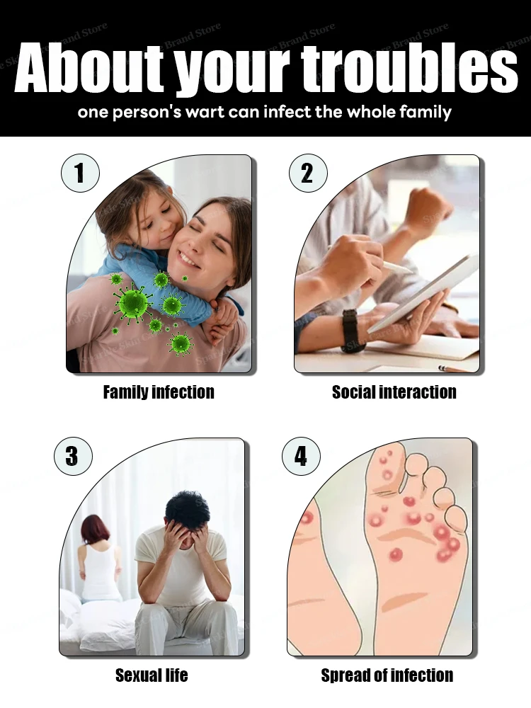 The first generation of improved  ᴡᴀʀᴛ ʀᴇᴘᴀɪʀ ᴀɢᴇɴᴛ ᴡᴀʀᴛ ʀᴏᴏᴛ ғᴀsᴛ 2