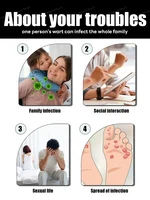 The first generation of improved  ᴡᴀʀᴛ ʀᴇᴘᴀɪʀ ᴀɢᴇɴᴛ ᴡᴀʀᴛ ʀᴏᴏᴛ ғᴀsᴛ 2