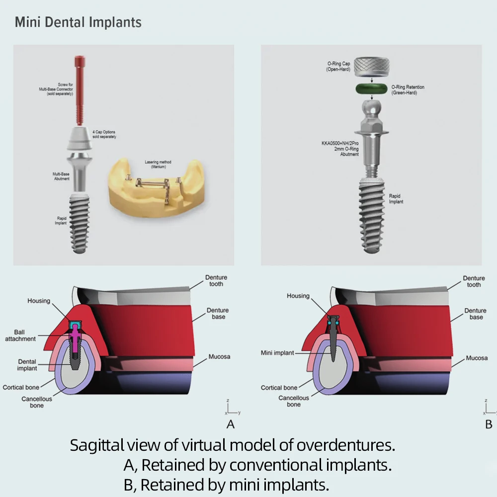 Dental Solutions