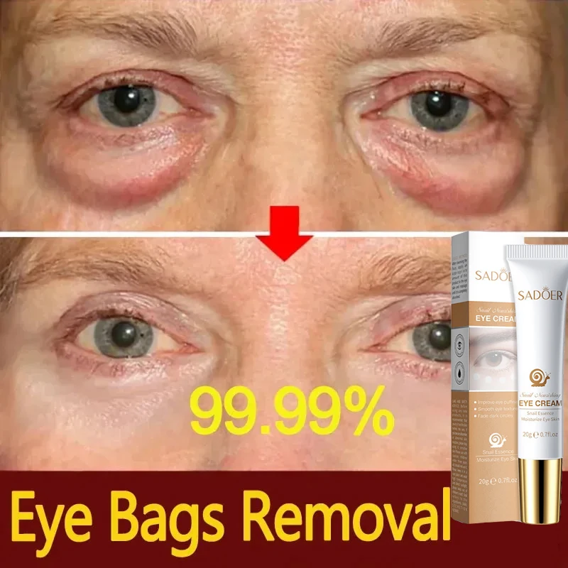 Instant Eye Bag Removal Cream Collagen Removal Wrinkles Lifting Fade Fine Lines Moisturizing Brightening Anti Puffiness Eye Care eye cream