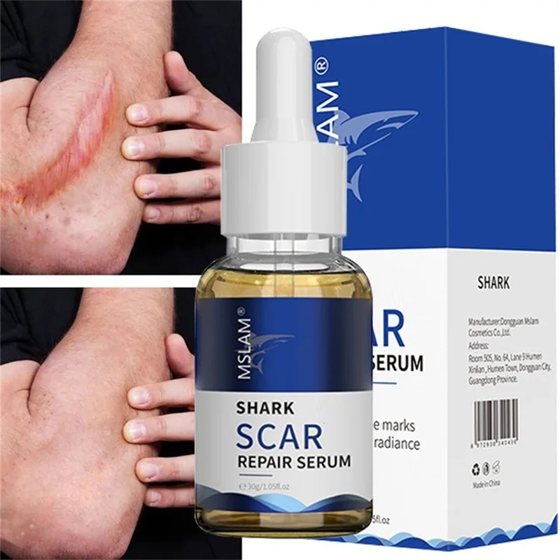 

Scar Removal Serum Remove Acne Spots Treatment Stretch Marks Burn Surgical Scar Repair Cream Smoothing Whitening Skin Beauty