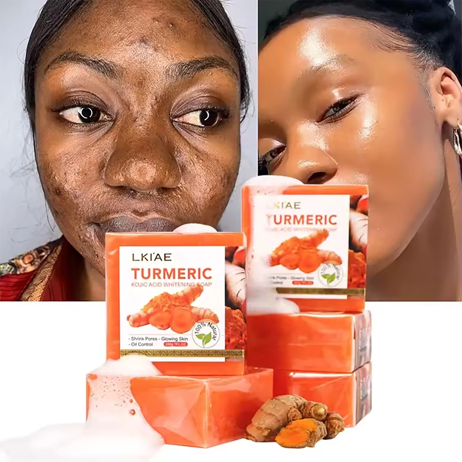 LKIAE Organic Turmeric Soap, Handmade, Whitening, for All Skin Types, Remove Black Spots, Melanin, Acne, For Face, Body, 200g