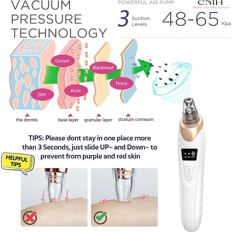 Professional blackhead remover vacuum device