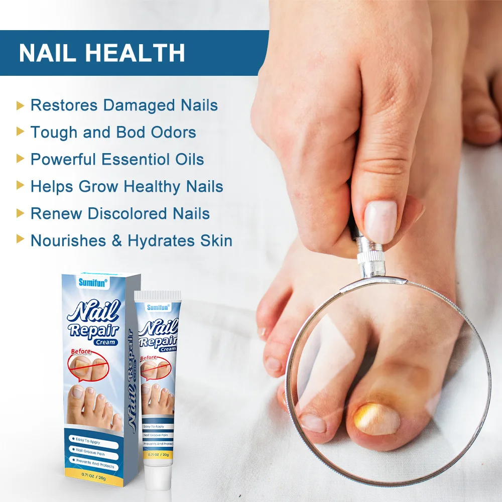 Nail Fungus Treatment Cream Foot Toe Nail Fungus Removal Serum Anti-infection Paronychia Onychomycosis Repair Gel Care U&ntilde;as
