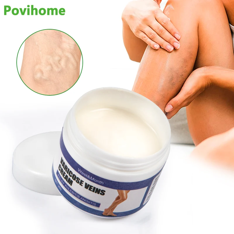 

Крем от варикозного расширения вен, 30 г