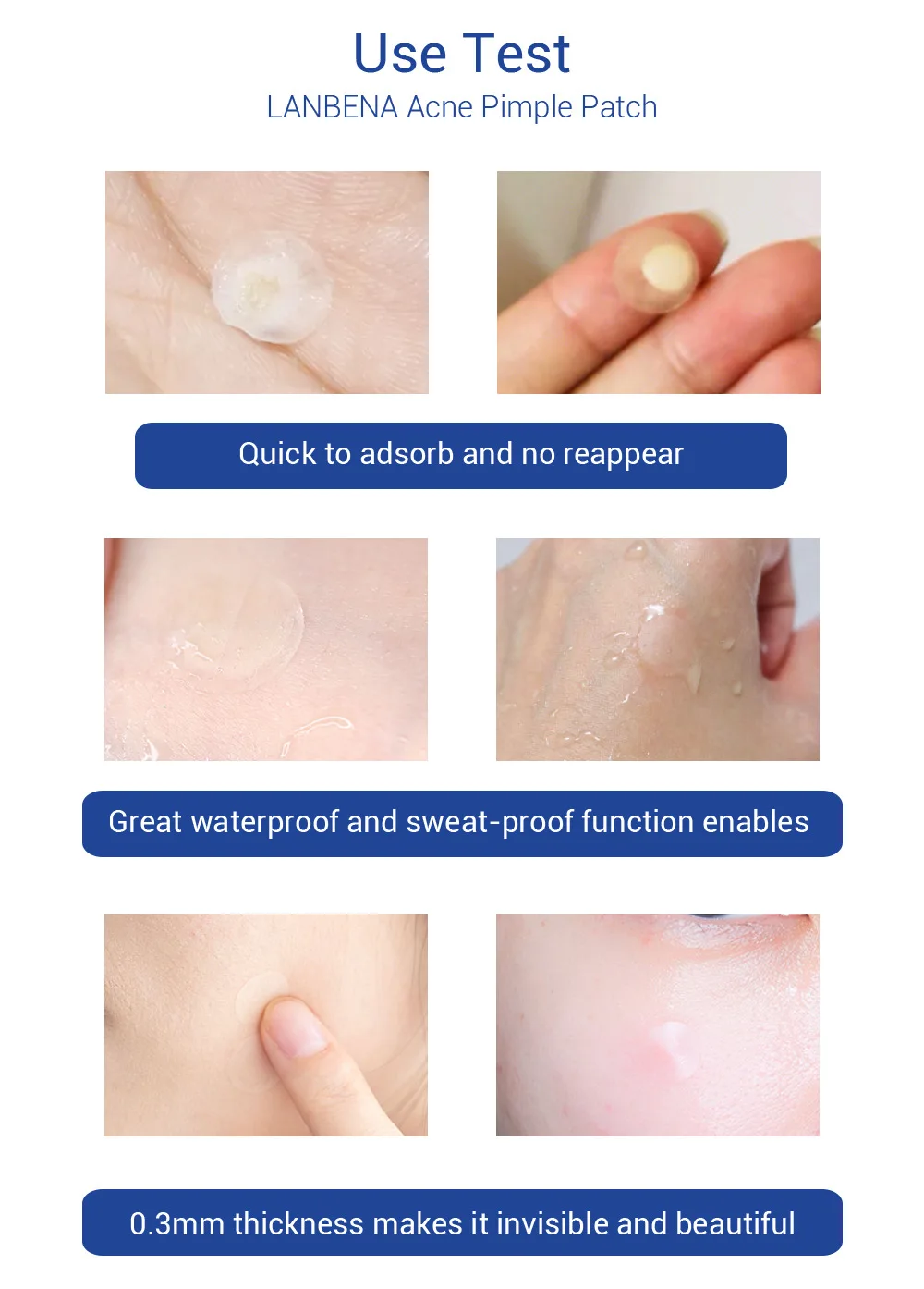 Description Picture 5 of itemLANBENA Invisible Acne Pimple Patch Face Mask Acne Pimple Blemish Removal Stickers Acne Treatment Master Daily / Night Use