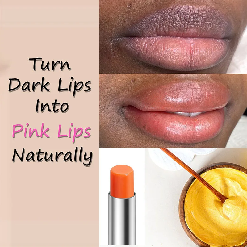 TurmericBalmGetRidofDarkLipsCurcuminReduceMelaninPigmentation