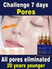 Removing Large Pores Pore Shrinking Serum Face Tightening Repairing Facial Pore Minimizing Moisturizing Skin Care Product 1