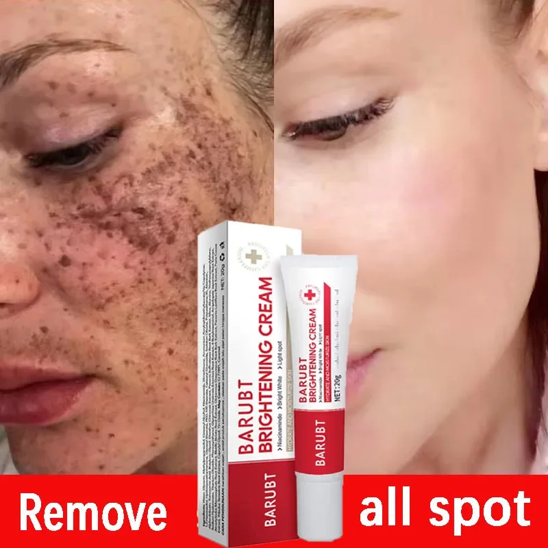 Effective Whitening Cream Freckles Dark Spots Removal Face Brighten Products Fade Melasma Corrector Lighten Melanin Beauty
