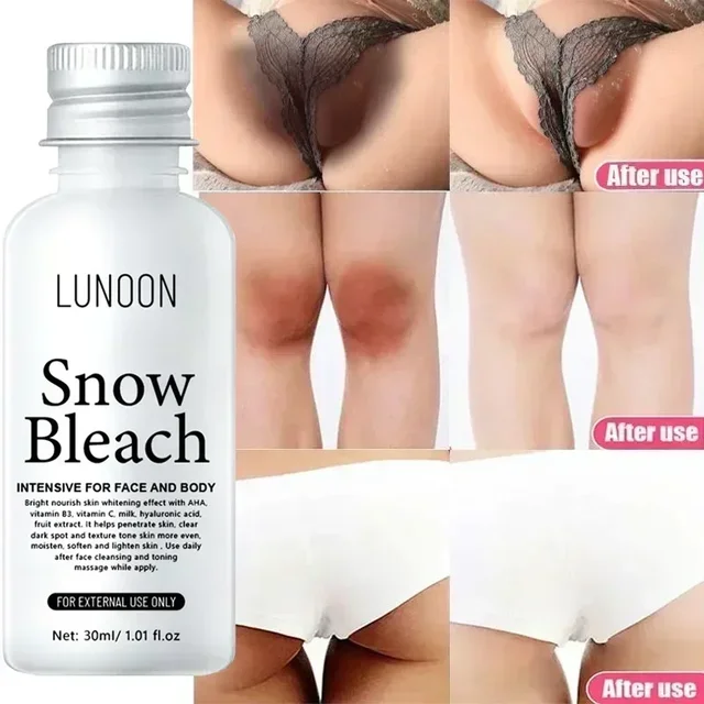 Crème blanchissante pour parties intimes, sérum blanchissant pour les aisselles, blanchit les fesses et les genoux, éclaircit l'intérieur des cuisses, parties intimes, élimine la mélanine foncée 1