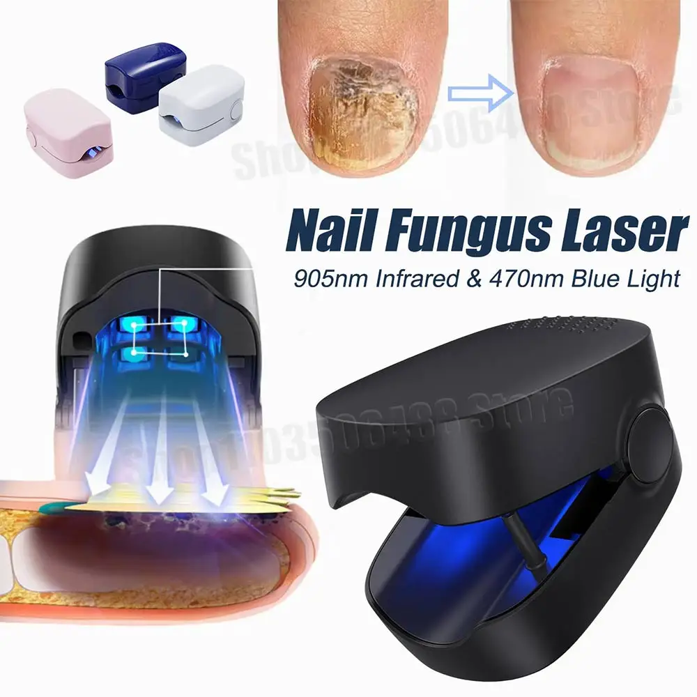 Nail Fungus Remover Laser Therapy Pen Nail Fungus Treatment Laser Device For Cleaning Onychomycosis USB Charge Anti Fungal Repair Damaged Discolored Thick Fingernails