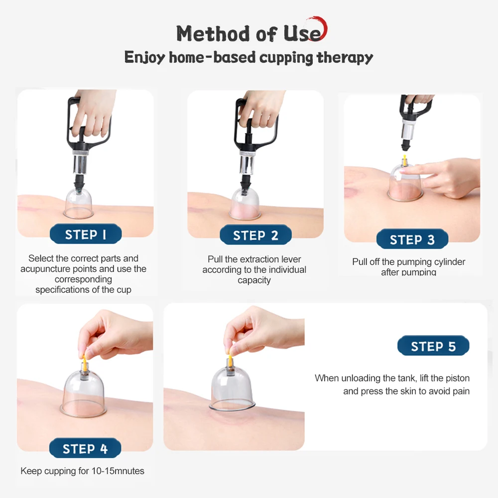 Cofoe 12/24 Cans Vacuum Cupping Machine Manual Cupping Massage Device Traditional Chinese Medicine Cupping Cups Beauty Health 6