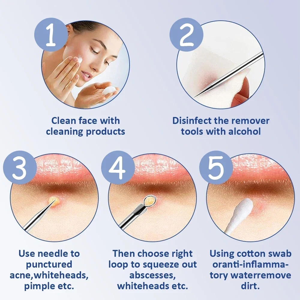 Professional Acne And Blackhead Removal Tool Kit For Face Care_voghion.com