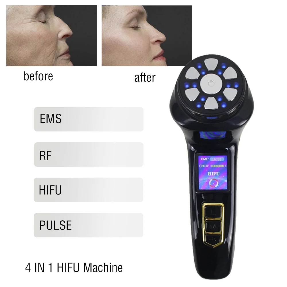 

Newest 3.0 LED Photon HIFU Machine Ultrasonic RF EMS Micro Current Facial Beauty Massager Home SPA Face Neck Lifting Anti Aging