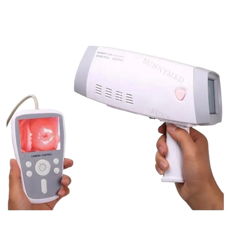 

SY-F005 Gynecology examination video colposcope cheap vaginal endoscope colposcope for gynecology