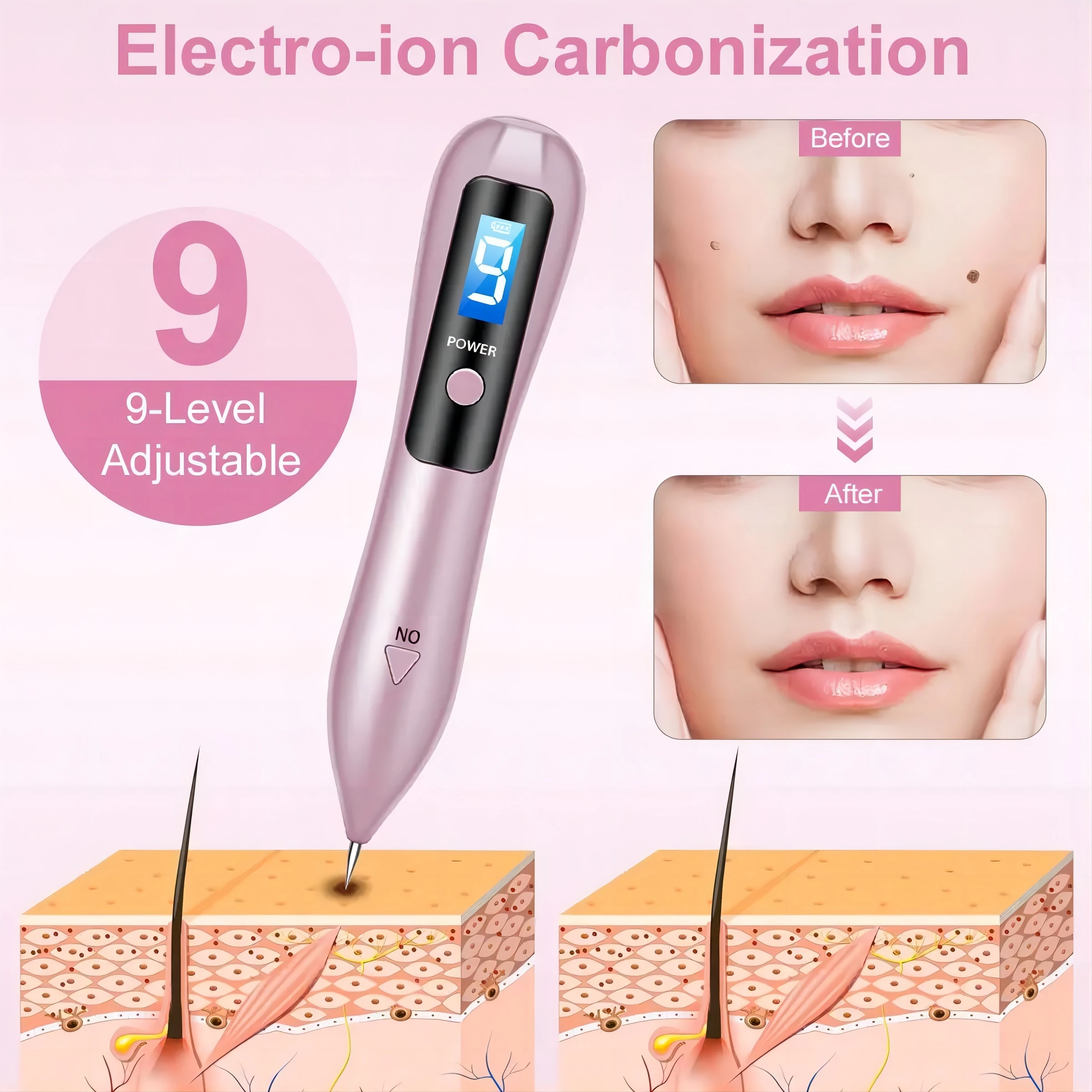 Skin Tag Removal Tool Skin Tag Removal Pen Liquid Crystal Laser Plasma Pen Tattoo Nevi Black Spot Wart Remover