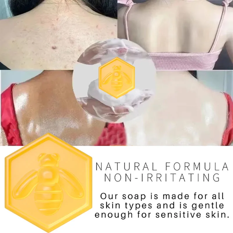 Body Whitening Soap Deep Clean Skin Chicken Skin Removal Soap Armpit Underarm Knees Bleaching Body Brighten White Care Products