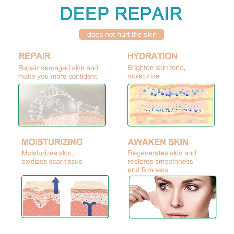 Рисунок 3 - 1 рулон, самоклеящиеся силиконовые шрамы