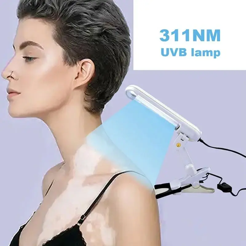 311NM UVB Phototherapy Lamp Device for Vitiligo Treatment UV
