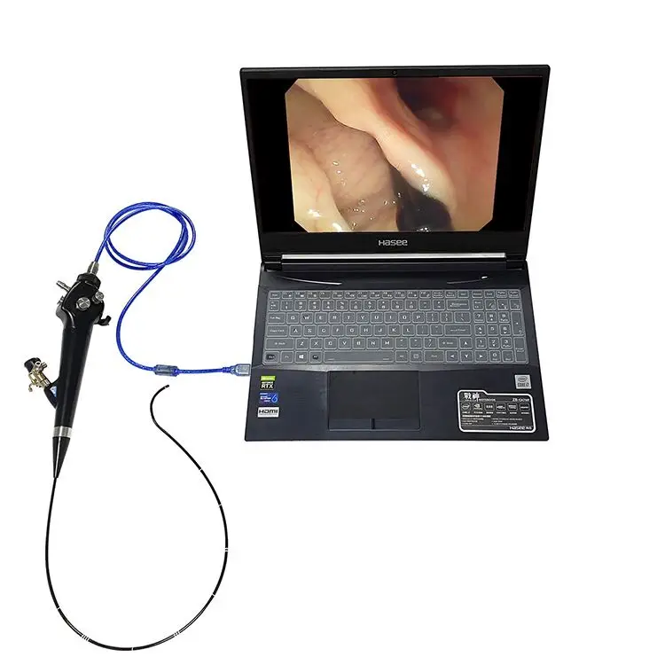 

Medical Ureteroscopy USB Portable Video Uresteroscope for Ureter and Kidney