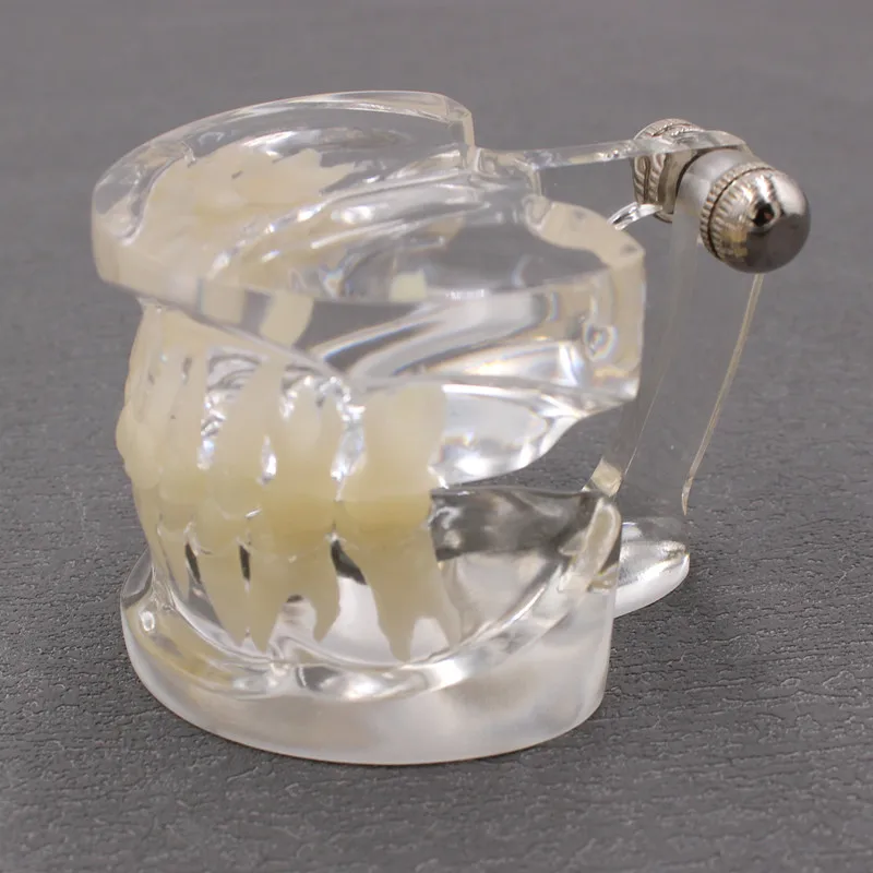 

Стоматологическая модель для детей, выпадающие перманентные зубы, переменное обучение, детская Стоматологическая Патология, профилактическая модель